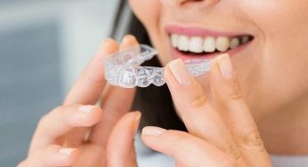 How Much Does Invisalign Cost in The UK?