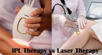 The Difference Between IPL and Laser Hair Removal